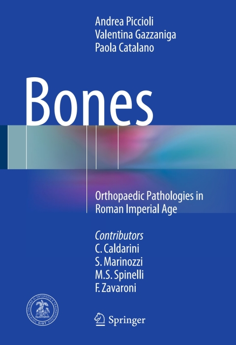 Cover image for book Bones