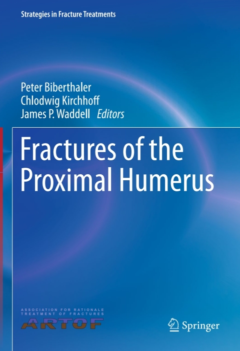 Cover image for book Fractures of the Proximal Humerus