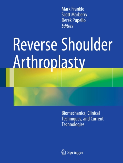 Cover image for book Reverse Shoulder Arthroplasty
