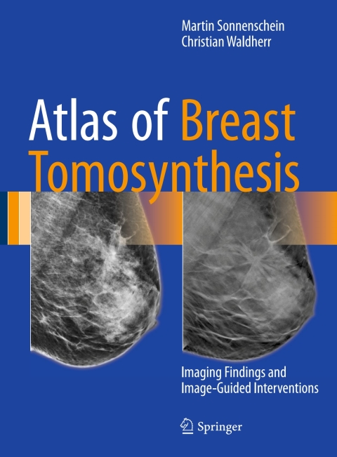 Cover image for book Atlas of Breast Tomosynthesis