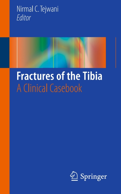 Cover image for book Fractures of the Tibia