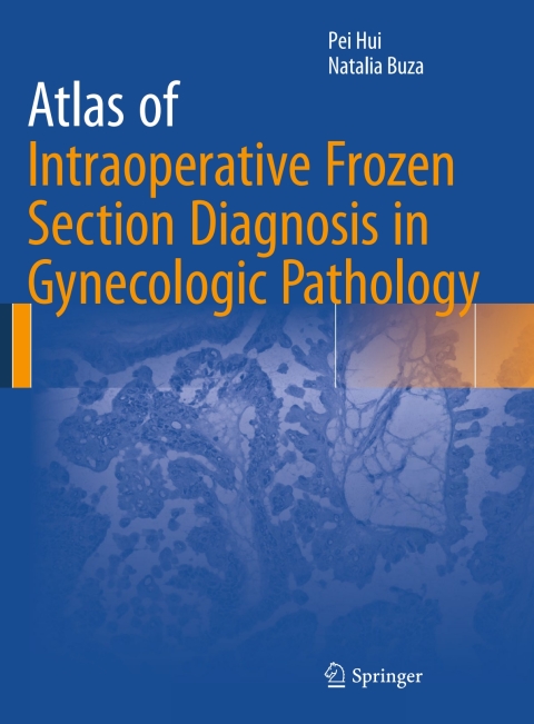 Cover image for book Atlas of Intraoperative Frozen Section Diagnosis in Gynecologic Pathology