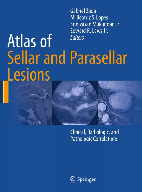 Cover image for book Atlas of Sellar and Parasellar Lesions