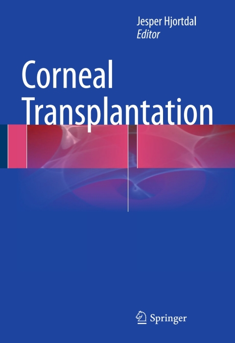 Cover image for book Corneal Transplantation