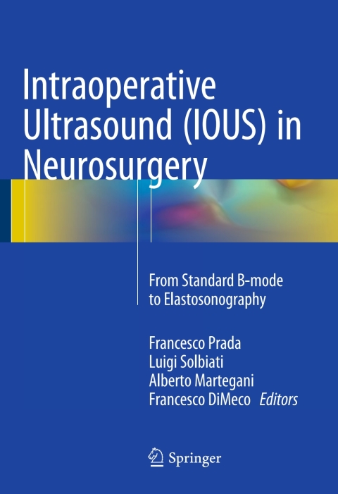 Cover image for book Intraoperative Ultrasound (IOUS) in Neurosurgery