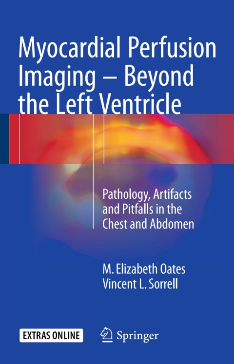 Cover image for book Myocardial Perfusion Imaging - Beyond the Left Ventricle