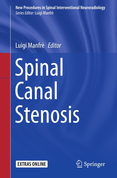 Cover image for book Spinal Canal Stenosis