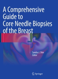 Titelbild: A Comprehensive Guide to Core Needle Biopsies of the Breast 9783319262895
