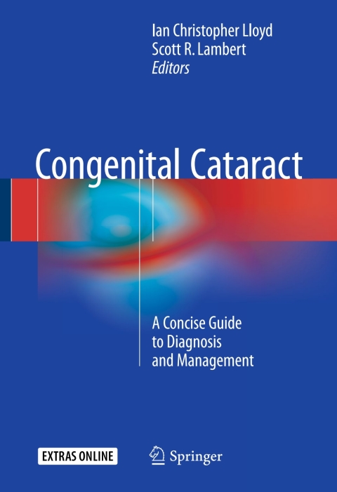 Congenital Cataract 