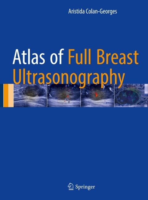 Cover image for book Atlas of Full Breast Ultrasonography