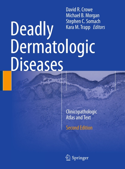 Deadly Dermatologic Diseases 