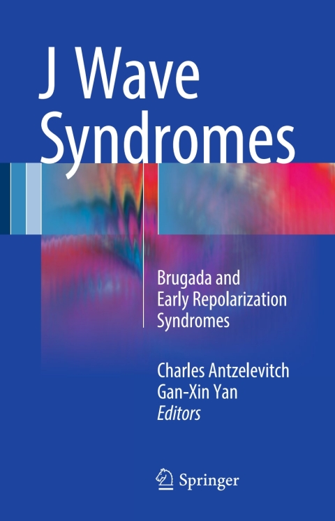 Cover image for book J Wave Syndromes