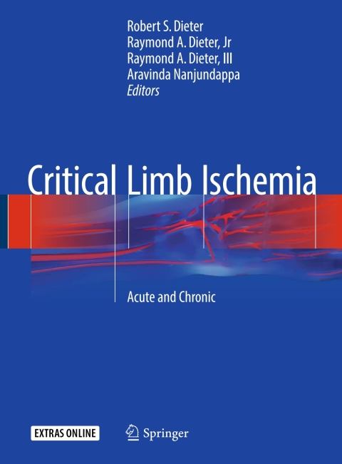 Cover image for book Critical Limb Ischemia