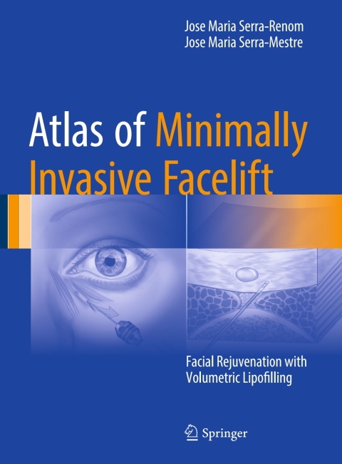 Cover image for book Atlas of Minimally Invasive Facelift