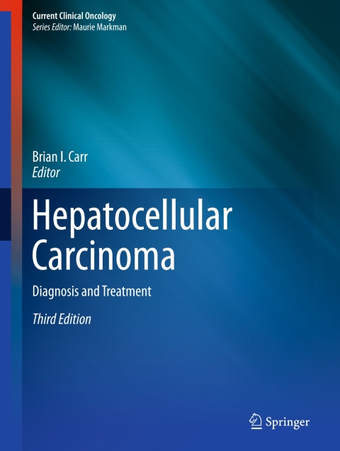 Cover image for book Hepatocellular Carcinoma