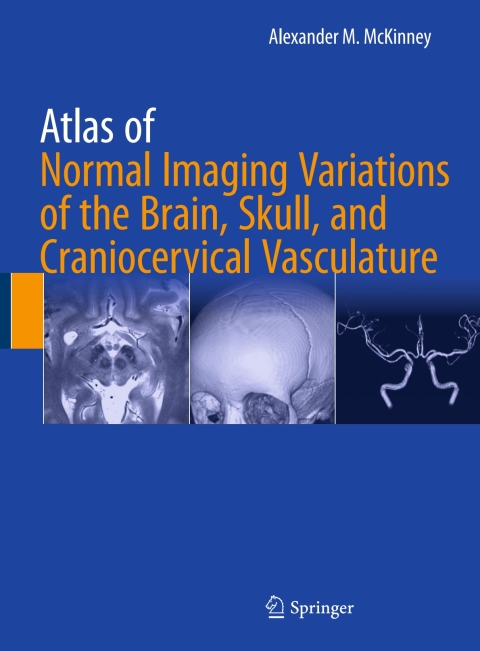Cover image for book Atlas of Normal Imaging Variations of the Brain, Skull, and Craniocervical Vasculature
