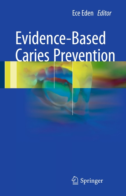 Cover image for book Evidence-Based Caries Prevention