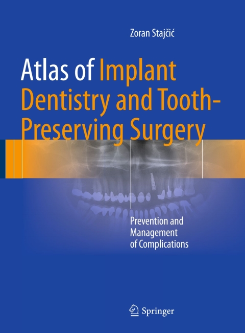 Cover image for book Atlas of Implant Dentistry and Tooth-Preserving Surgery