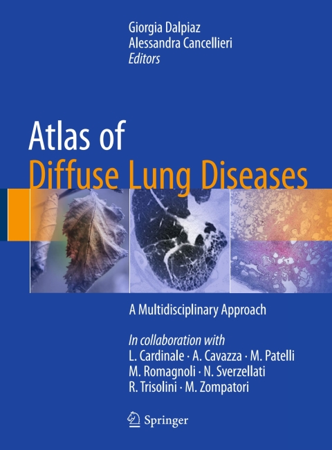 Cover image for book Atlas of Diffuse Lung Diseases