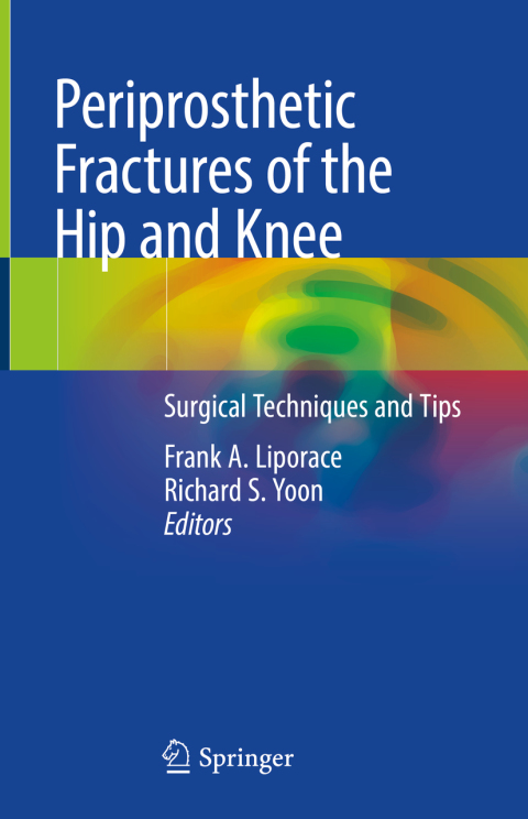 Cover image for book Periprosthetic Fractures of the Hip and Knee