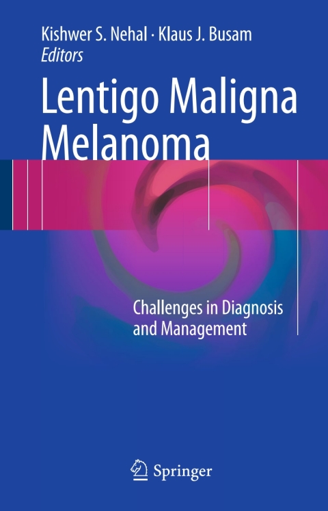 Cover image for book Lentigo Maligna Melanoma