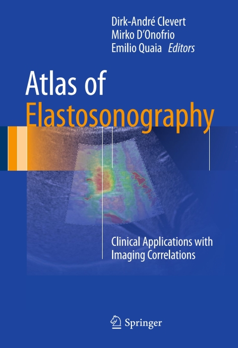 Cover image for book Atlas of Elastosonography