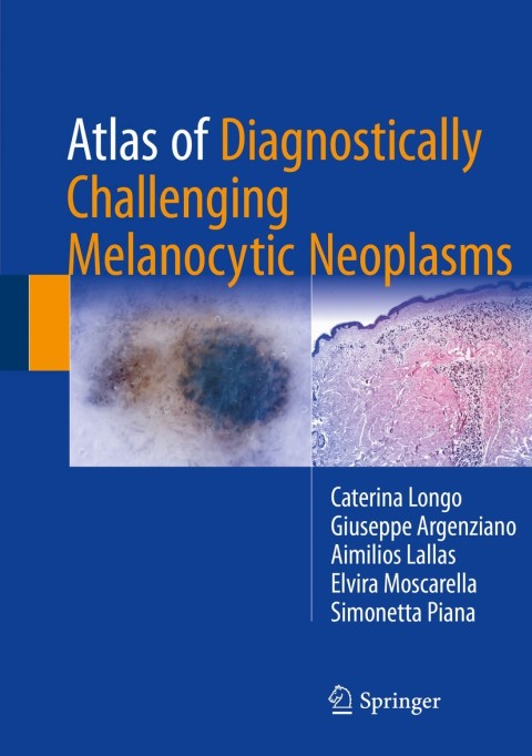 Cover image for book Atlas of Diagnostically Challenging Melanocytic Neoplasms