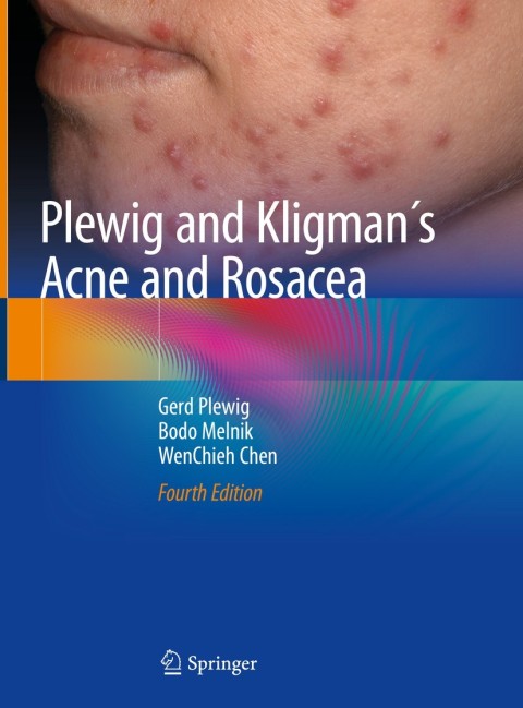 Cover image for book Plewig and Kligman´s Acne and Rosacea