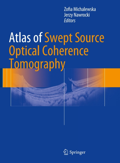 Cover image for book Atlas of Swept Source Optical Coherence Tomography