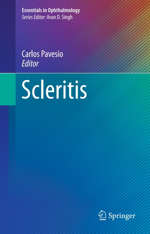 Cover image for book Scleritis