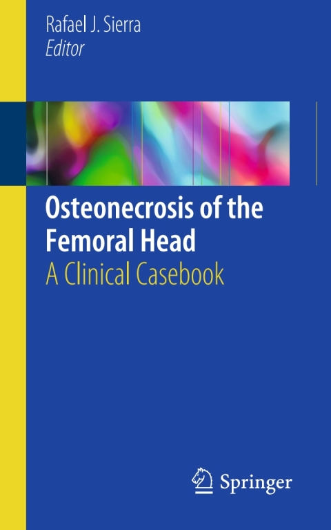 Cover image for book Osteonecrosis of the Femoral Head