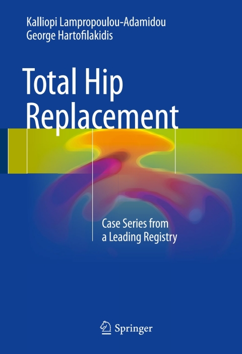 Cover image for book Total Hip Replacement