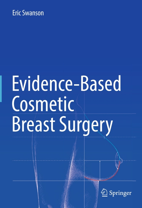 Cover image for book Evidence-Based Cosmetic Breast Surgery