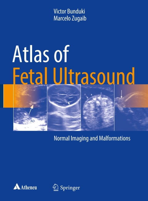 Cover image for book Atlas of Fetal Ultrasound