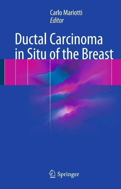 Cover image for book Ductal Carcinoma in Situ of the Breast