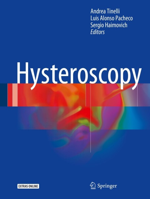 Cover image for book Hysteroscopy