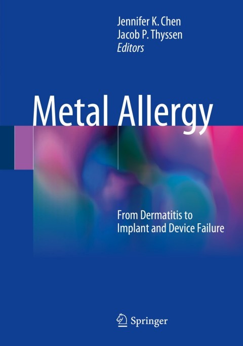 Cover image for book Metal Allergy