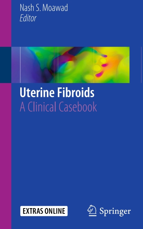 Cover image for book Uterine Fibroids