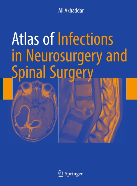 Cover image for book Atlas of Infections in Neurosurgery and Spinal Surgery