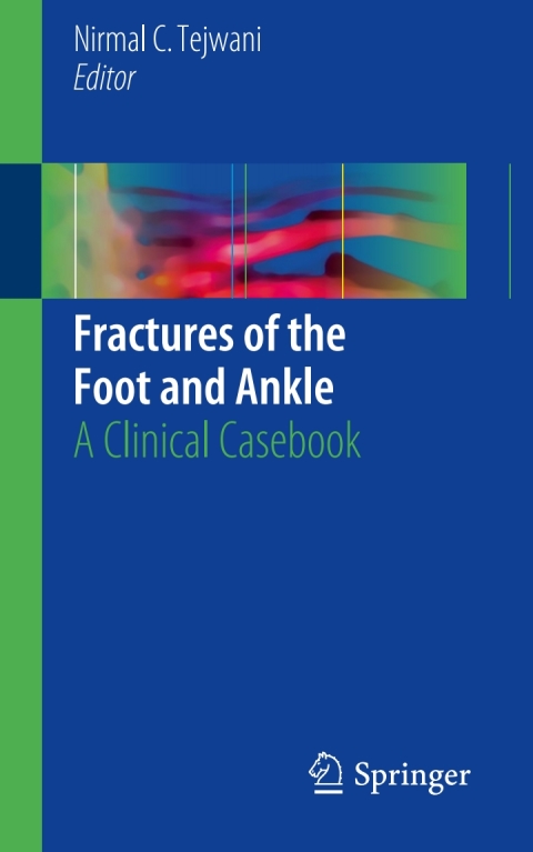 Cover image for book Fractures of the Foot and Ankle