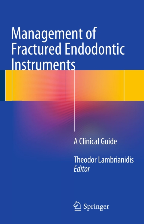 Cover image for book Management of Fractured Endodontic Instruments