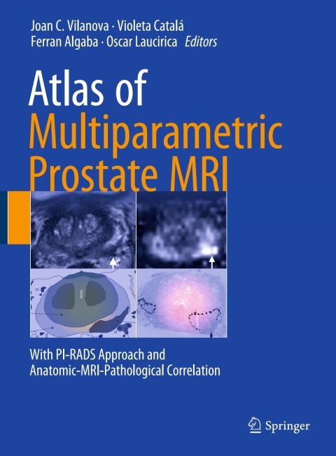 Cover image for book Atlas of Multiparametric Prostate MRI