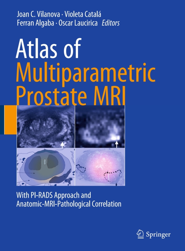 Atlas of Multiparametric Prostate MRI