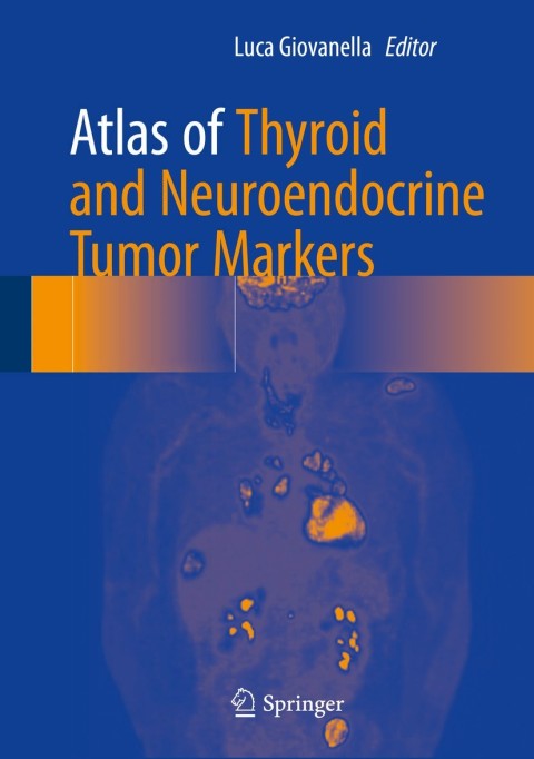 Cover image for book Atlas of Thyroid and Neuroendocrine Tumor Markers