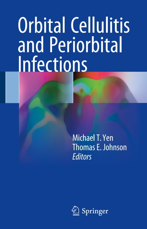 Cover image for book Orbital Cellulitis and Periorbital Infections