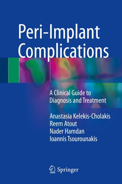 Cover image for book Peri-Implant Complications