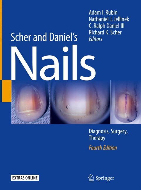 Cover image for book Scher and Daniel's Nails