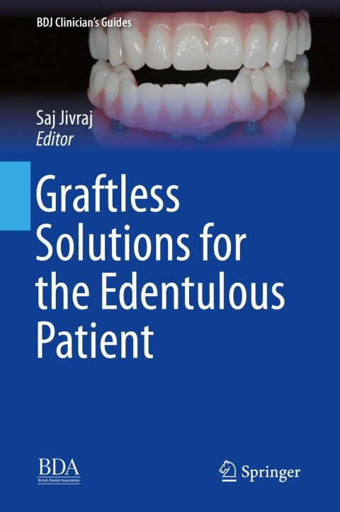 Cover image for book Graftless Solutions for the Edentulous Patient