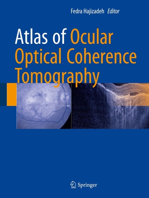 Cover image for book Atlas of Ocular Optical Coherence Tomography