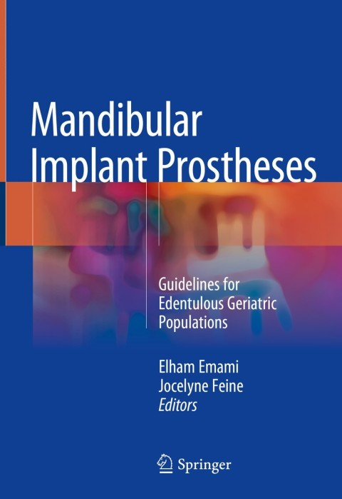 Cover image for book Mandibular Implant Prostheses